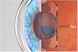 Comfort multifocal intraocular lens