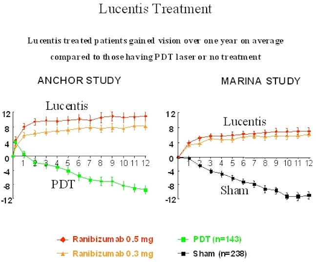 Lucentis Treatment