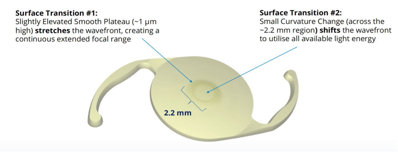 Alcon Vivity Lens implant Tanner Eyes